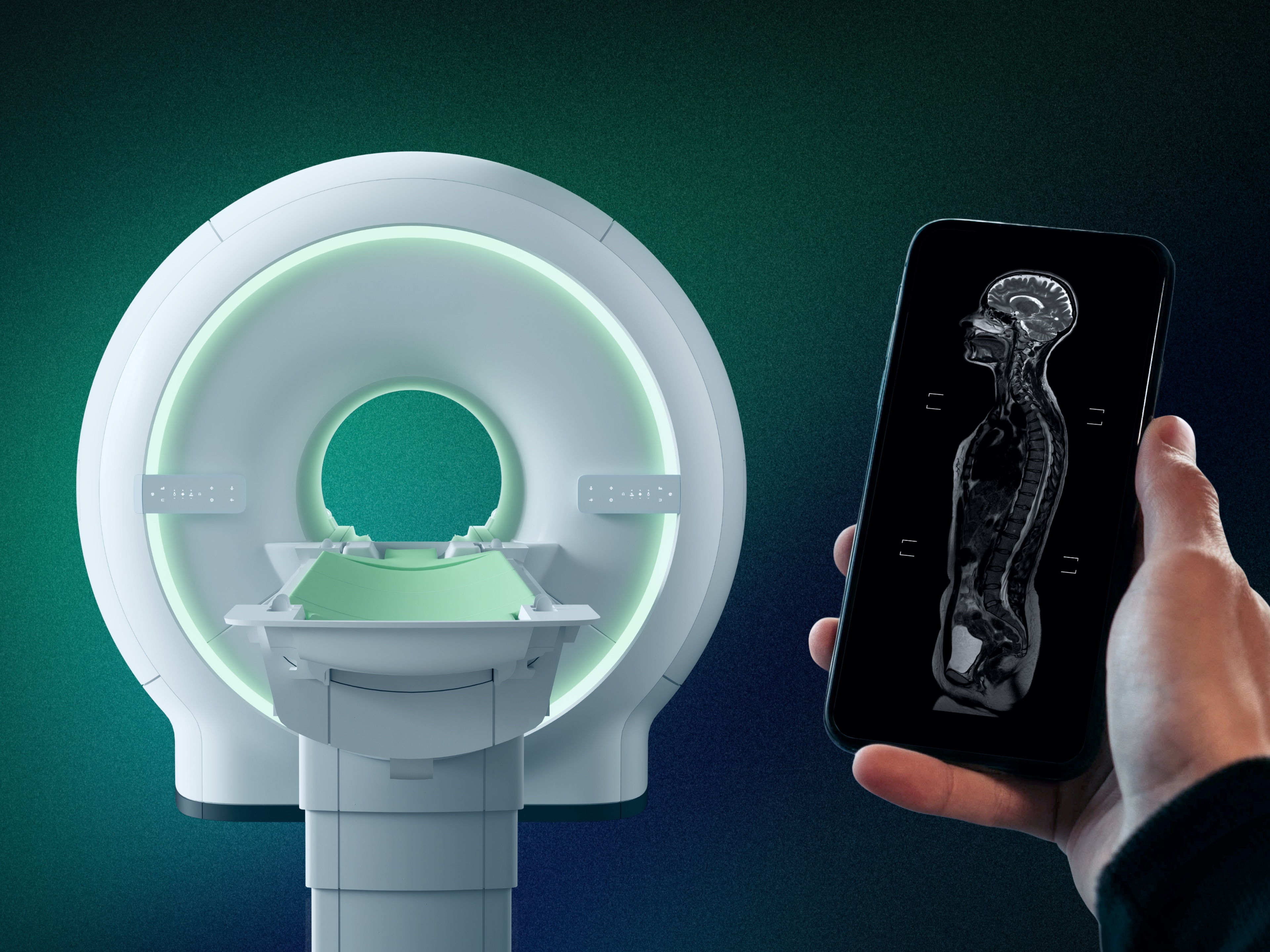 Prenuvo whole body MRI scan